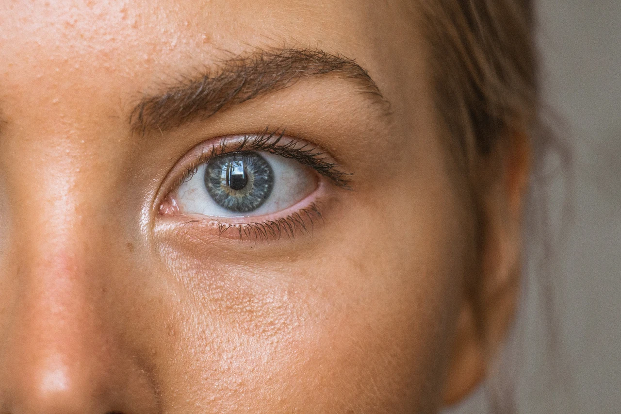 Pelle grassa e brufoli: come la qualità dell’aria li peggiora Pelle grassa e brufoli: come la qualità dell’aria li peggiora